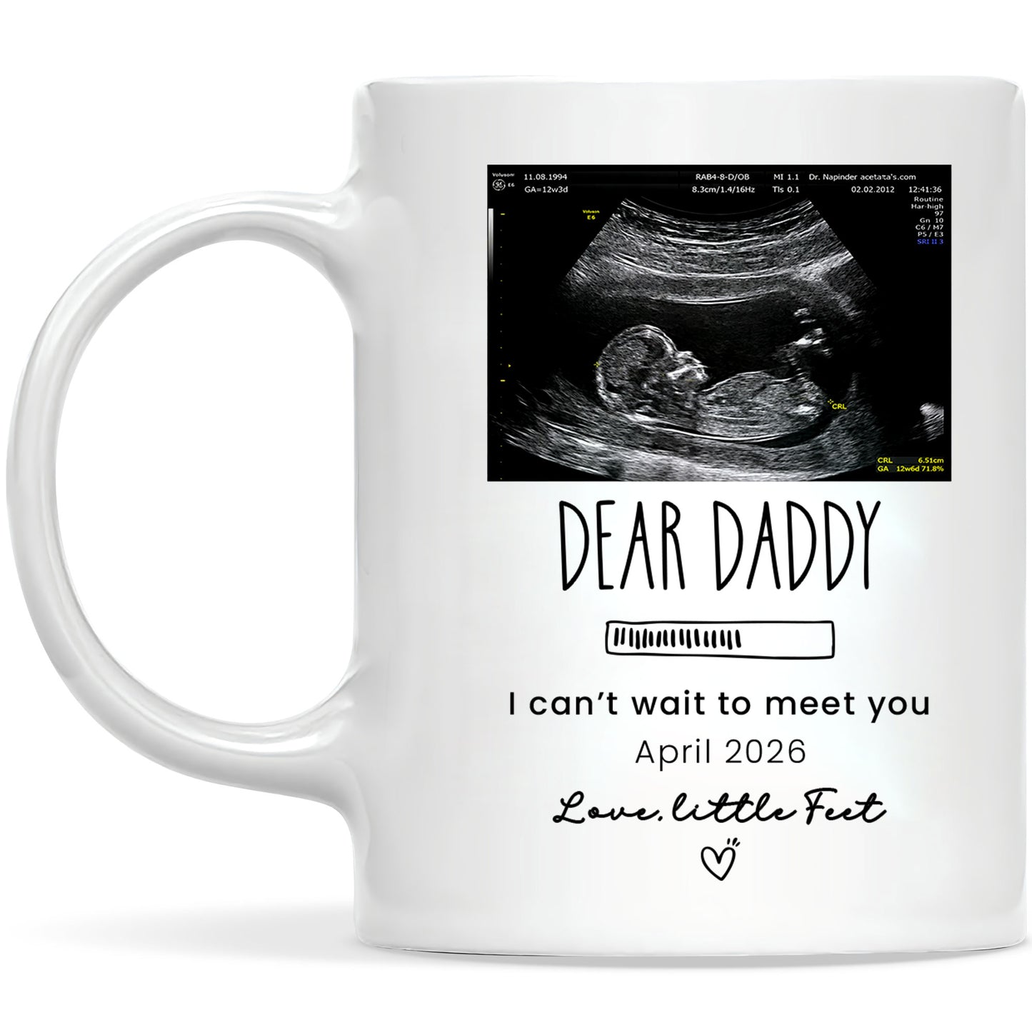 Personalized Daddy Mug – Custom Photo Coffee Mug Gift for Dad